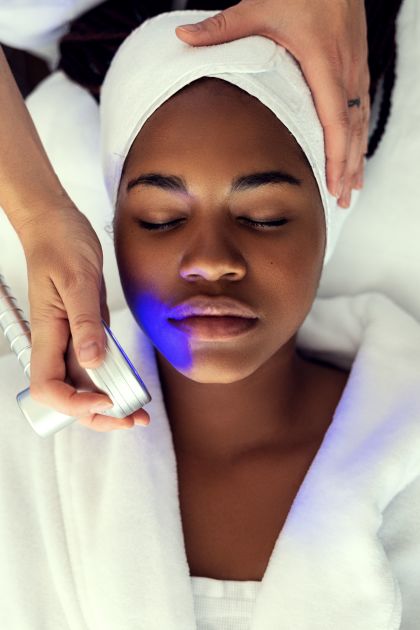 MICRONEEDLING INTENSIVE MIT RADIOFREQUENZ – 3 Sessions MICRONEEDLING INTENSIVE MIT RADIOFREQUENZ – 3 Sessions