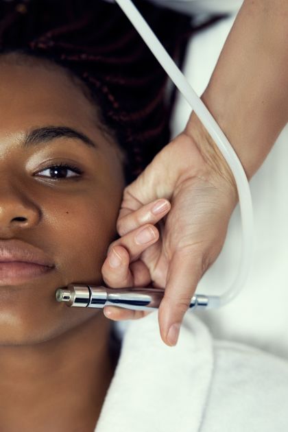 MICRONEEDLING INTENSIVE MIT RADIOFREQUENZ – 3 Sessions MICRONEEDLING INTENSIVE MIT RADIOFREQUENZ – 3 Sessions